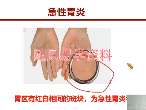 刘国平  乾坤手诊之六大诊断系统线上课视频10集